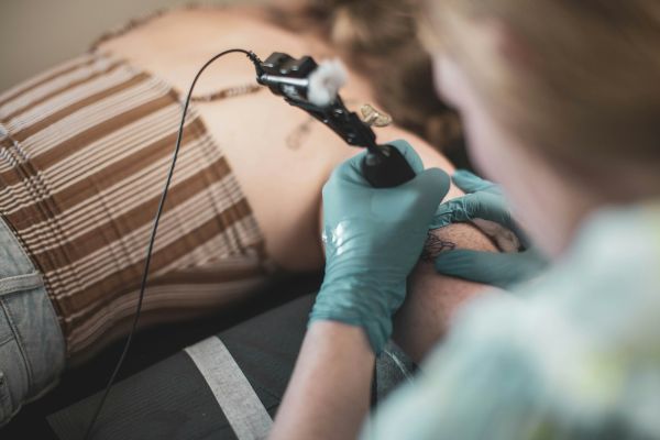 Les meilleures options pour enlever un tatouage au laser